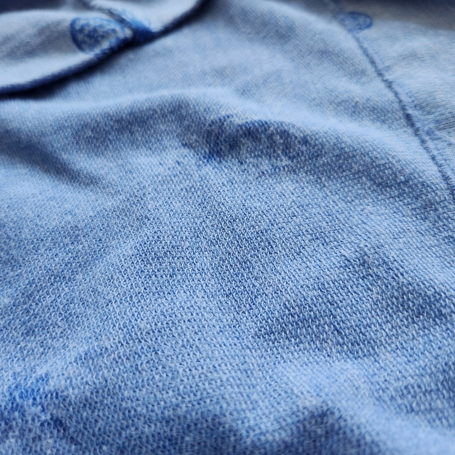 Lilly Pulitzer Skipper Popover Dress – Bennet Blue Pineapple Burnout – Women's Size XS